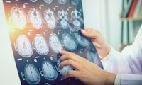 Ein einziger Gehirnscan statt dutzende Untersuchungen: Wie KI künftig Demenz erkennen soll