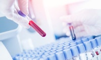 Auch das noch: Forschende finden Mikroplastik in Blutproben