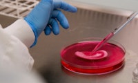 Ohr aus dem 3D-Drucker: Frau erhält erstes Gewebeimplantat aus eigenen Zellen